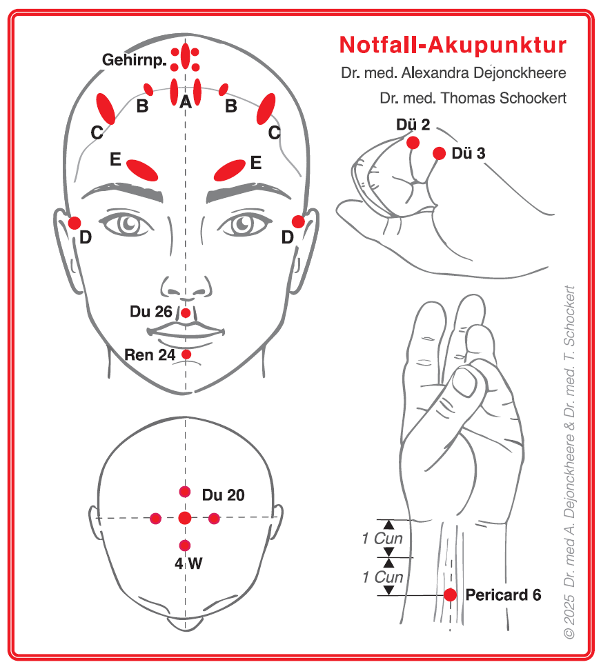 Notfallakupunktur-Einsteckkarten (deutsch)