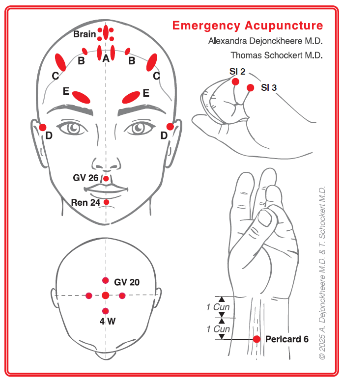 Package: Acupuncture in Emergency Medicine (Workbook Part 1+2, English) + Videos + Emergency Acupuncture Reference Cards (english)