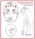 Emergency Acupuncture Reference Cards (english)
